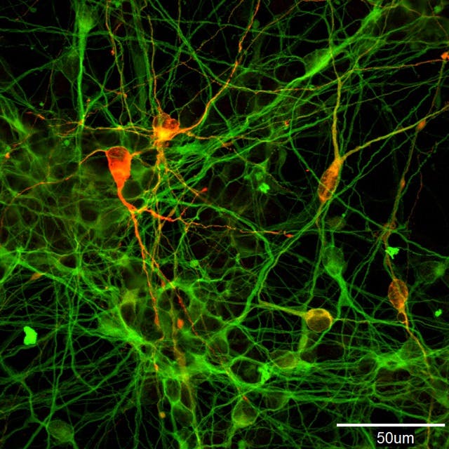 ヒトiPS細胞由来ドーパミン産生神経細胞 ©京都大学iPS細胞研究所 森実飛鳥
